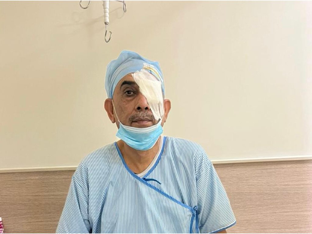 Do’s and Don’ts after cataract surgery