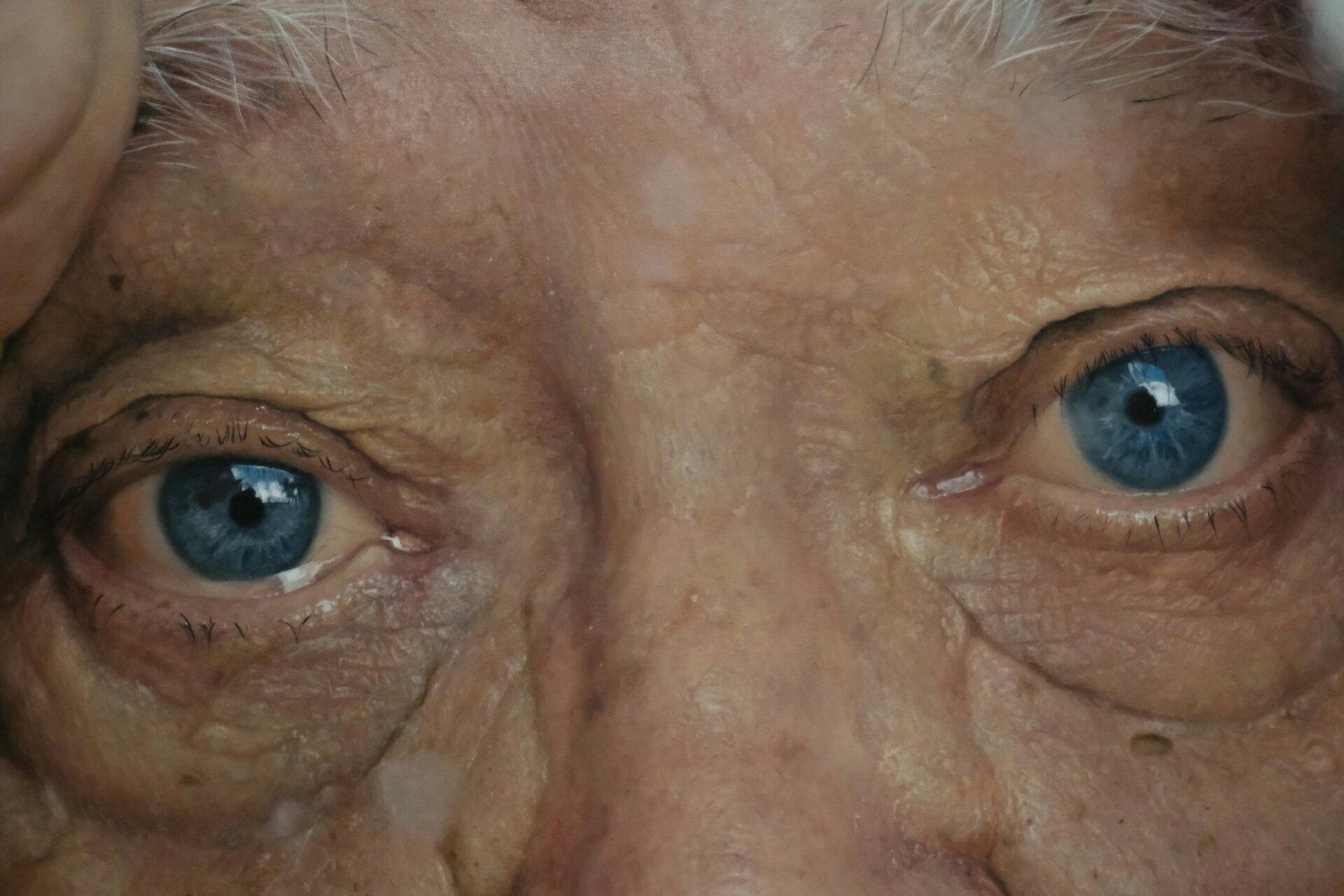 Can Cataract Come Back After Surgery?