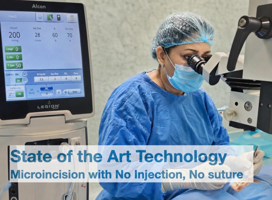 Best Cataract Surgery in Delhi